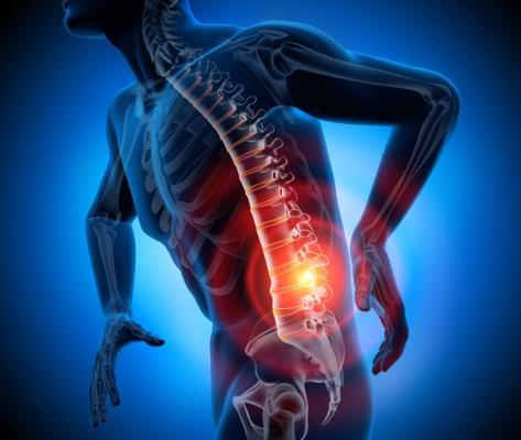 Mal de dos Mal de dos